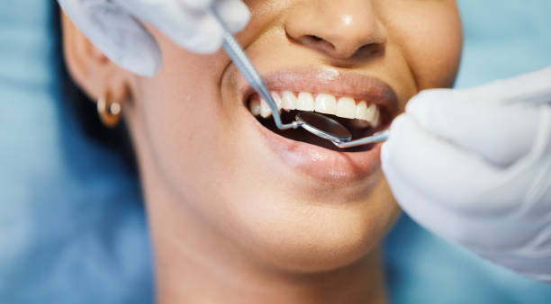 Best Emergency Dental Care for Broken or Chipped Teeth in Plainview, MN